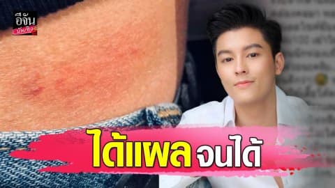 “มาสุ” เจอมิจฉาชีพเข้าชาร์จขโมยกล้อง ขณะเที่ยวอัมสเตอร์ดัม