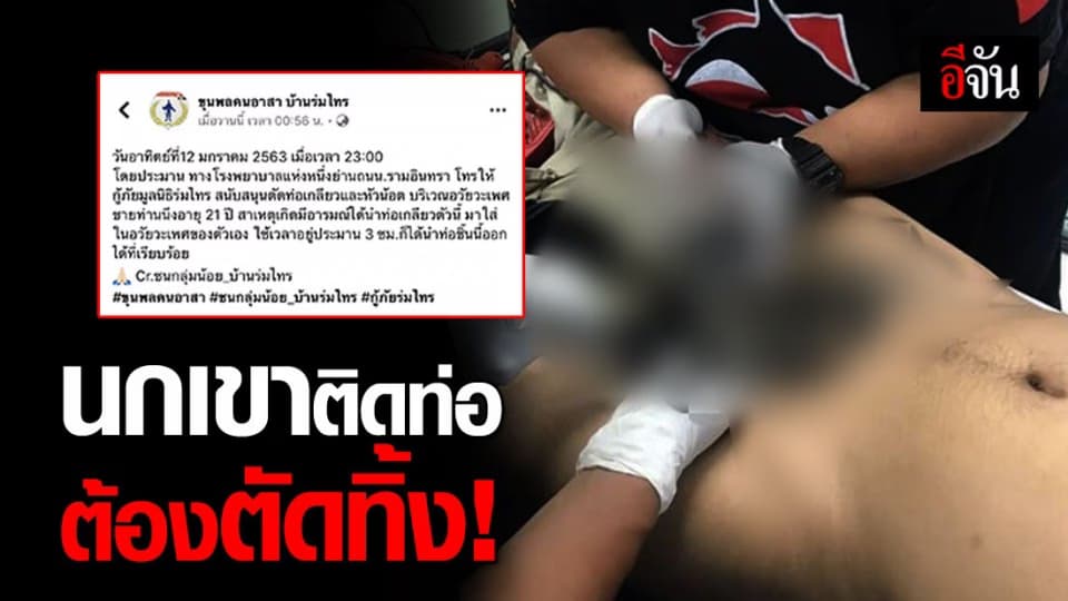 สุดช็อก หนุ่มใช้ท่อช่วยตัวเอง จนนกเขาติดท่อ!