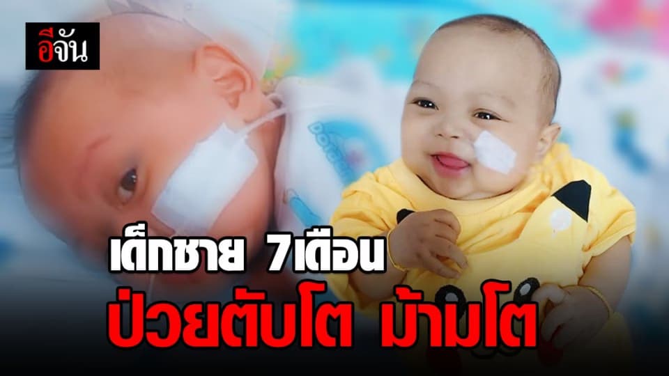 แม่โพสต์วอนช่วยลูกชายวัย 7 เดือน ป่วยเป็นโรค ตับโต ม้ามโต