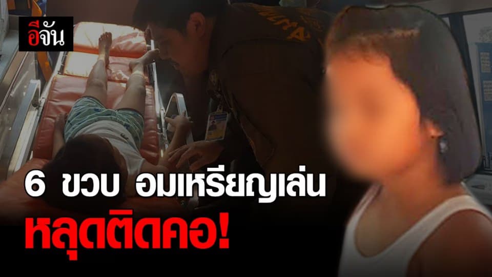 เด็กหญิงวัย 6 ขวบ อมเหรียญบาทเล่น เผลอกลืนเหรียญ หลุดติดคอ