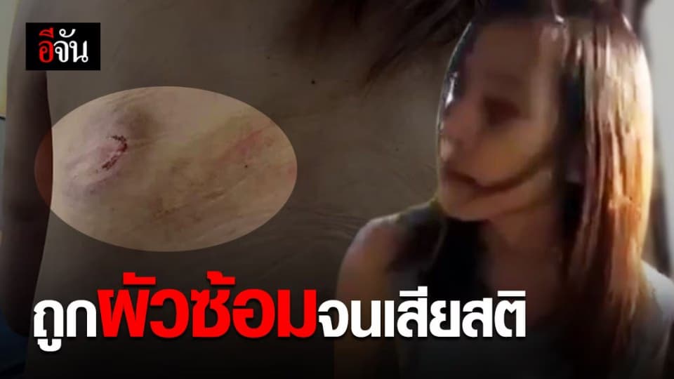 สะเทือนใจ… สาวแม่ลูกอ่อน ถูกสามีทำร้ายจนเสียสติ