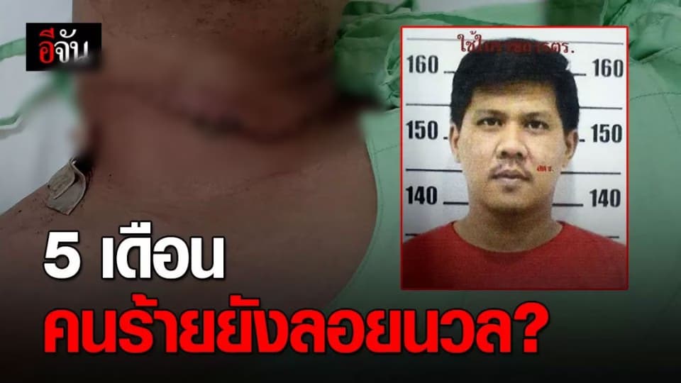 หนุ่มร้องกองปราบฯ ตามจับคนร้าย ถูกปาดคอเกือบตาย 5 เดือนคดีไม่คืบ