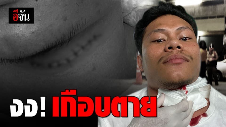 หนุ่มวัย 29 เกือบตาย! โดนชายนิรนามล็อก ปาดคอหวิดขาด