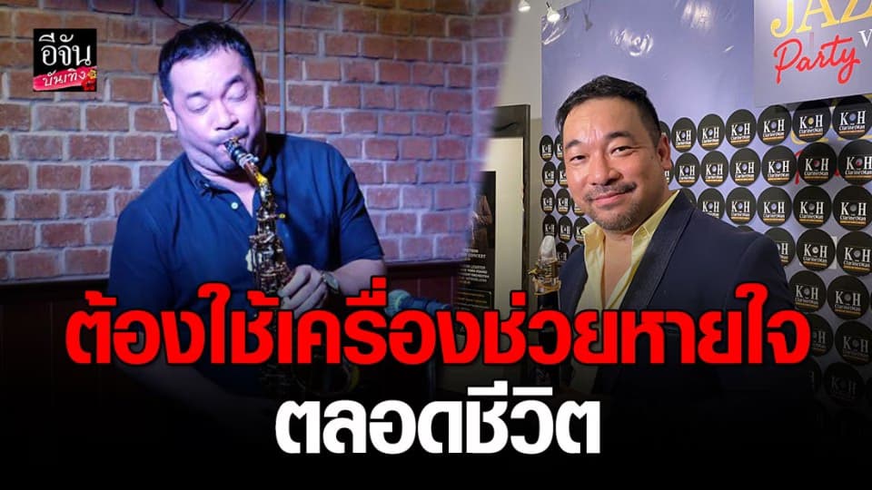 “โก้ มิสเตอร์แซกแมน” เป็นโรคหยุดหายใจระหว่างหลับ ต้องใช้เครื่องช่วยหายใจไปตลอดชีวิต