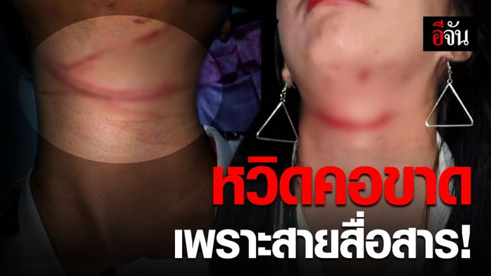 สายไฟสื่อสาร เกี่ยวคอเป็นแผลเหวอะ