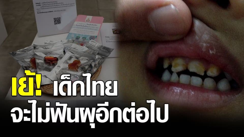 นักวิจัย ม.อ.คิดค้น “จุลินทรีย์โพรไบโอติกสายพันธุ์ใหม่” ป้องกันฟันผุ