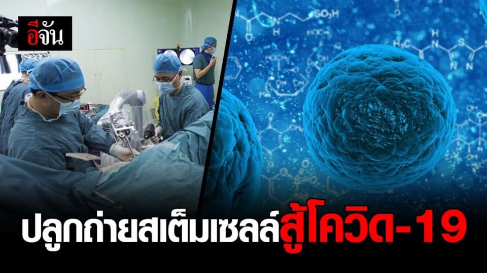 จีนปลูกถ่ายสเต็มเซลล์รักษาโควิด-19