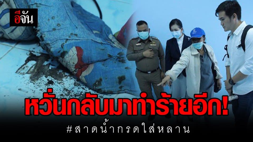 3 แม่-ลูก เหยื่อน้าสาวสาดน้ำกรด อาการยังน่าห่วง