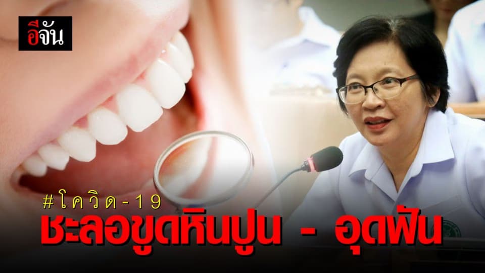 กรมอนามัย แนะชะลอ ขูดหินปูน-อุดฟัน-ผ่าฟันคุด ช่วงโควิด-19 ระบาด