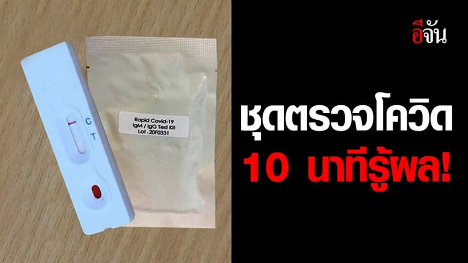 จุฬาฯ ผลิตชุดตรวจโควิด-19 สำเร็จ 10 – 15 นาที รู้ผล!