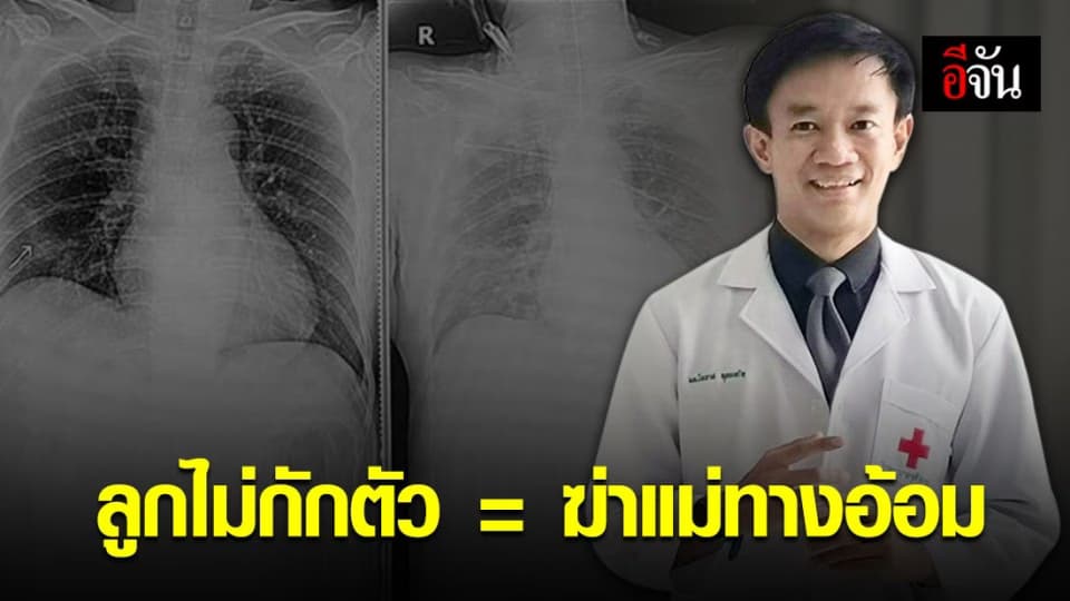 การส่งผ่านเชื้อโควิด-19 แบบไม่ได้ตั้งใจ ก็ทำให้คนรอบข้างติดแบบไม่ได้ตั้งใจ
