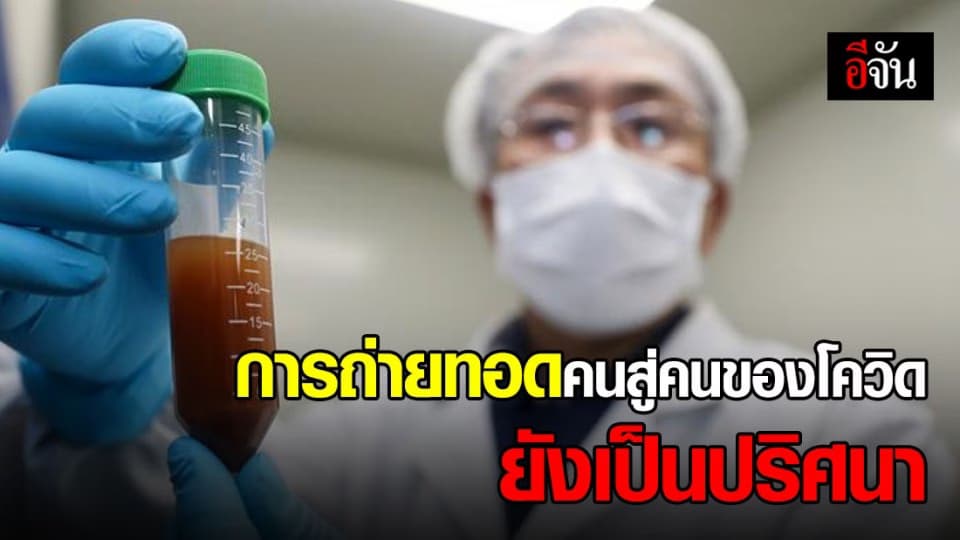 ผู้เชี่ยวชาญมหาวิทยาลัยลอนดอน เผย ต้องเรียนรู้ไวรัสโควิดอีกเยอะ การวิจัยสำคัญที่สุด