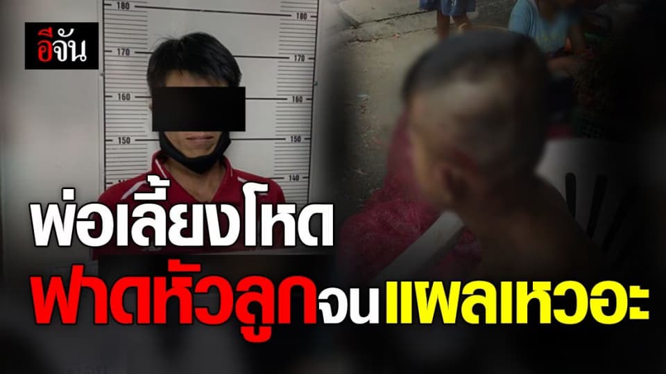 สลดใจ พ่อเลี้ยงคนไทย ใช้ไม้บรรทัดเหล็กตีหัวลูกชายชาวเมียนมา จนแผลเหวอะ