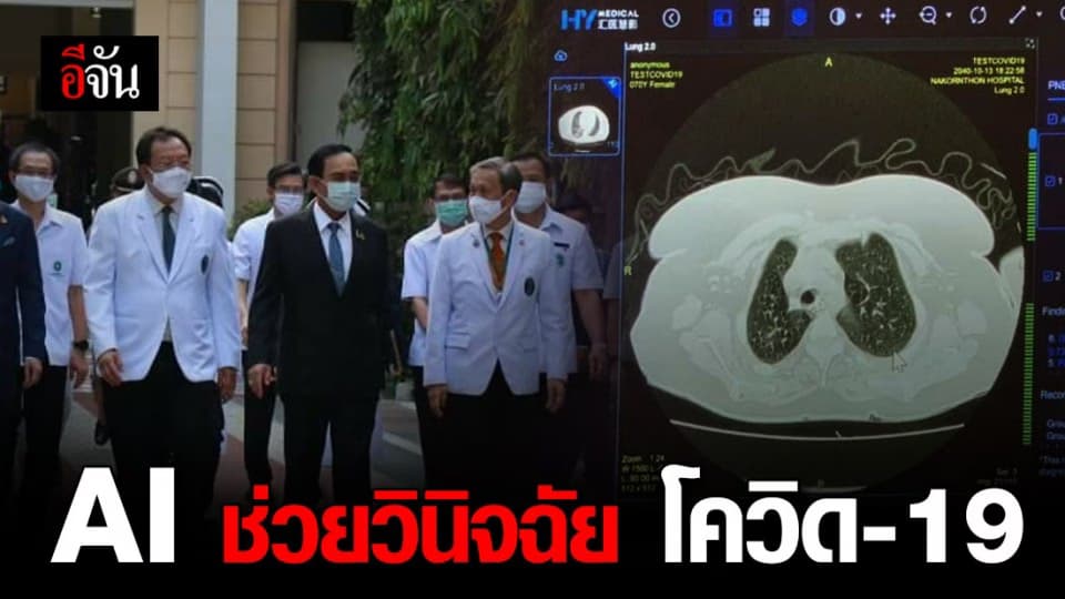 ศิริราชฯ ใช้ AI วิเคราะห์การติดเชื้อโควิด-19 ลดความเสี่ยงแพทย์-พยาบาล