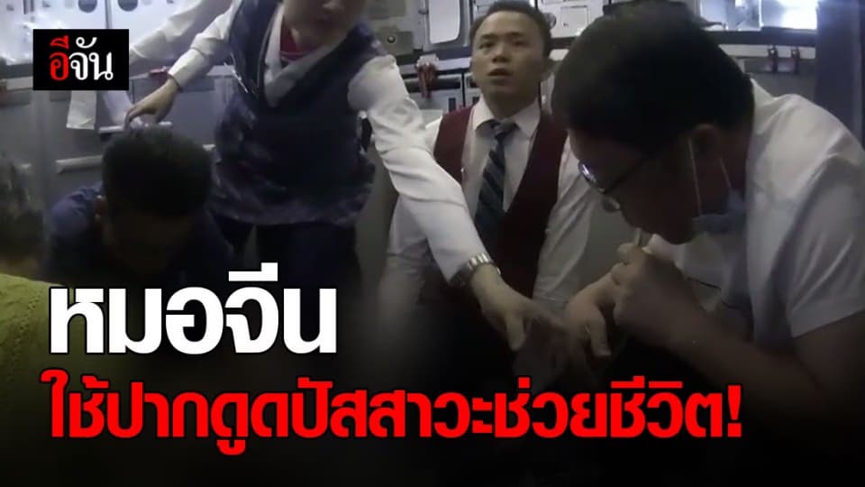 น่าชื่นชม หมอจีน ใช้ปากดูดปัสสาวะช่วยชีวิตคนไข้ต่อมลูกหมากโต บนเครื่องบิน