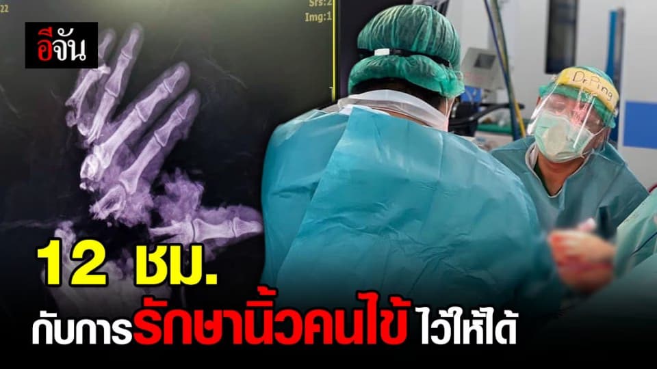 เรื่องเล่าจากห้องผ่าตัด หมอเล่า 12 ชม. กับความพยายามรักษานิ้วของคนไข้ไว้ให้ได้มากที่สุด
