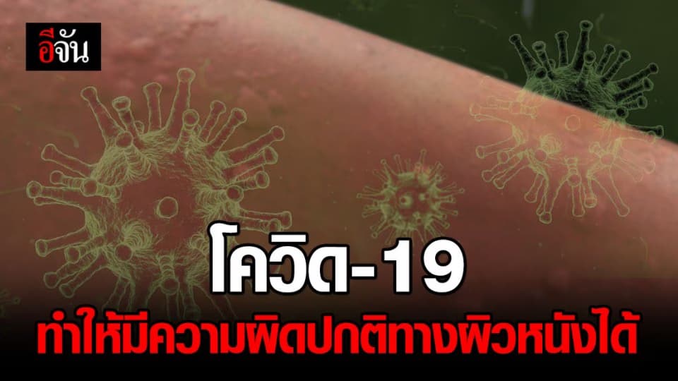 แพทย์ผิวหนัง ชี้ โควิด-19 ทำให้เกิดความผิดปกติทางผิวหนังได้