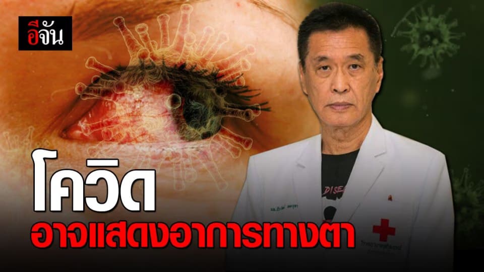 หมอธีระวัฒน์ ชี้ โอกาสกว่า 30% ที่โควิด-19 จะแสดงอาการทางตา