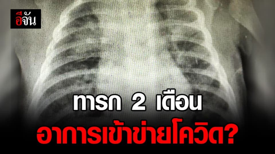 หมอเผยทารก 2 เดือน มีอาการเข้าข่ายโควิด? หวั่นระบาดระลอก 2