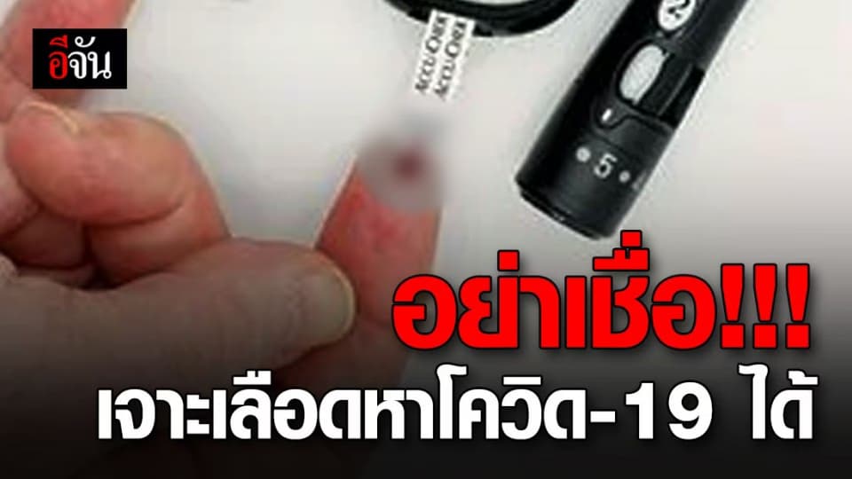 อย่าหลงเชื่อโฆษณา เจาะเลือดหาโควิด-19  กรมวิทยาฯ ยังไม่รับรองความแม่นยำ
