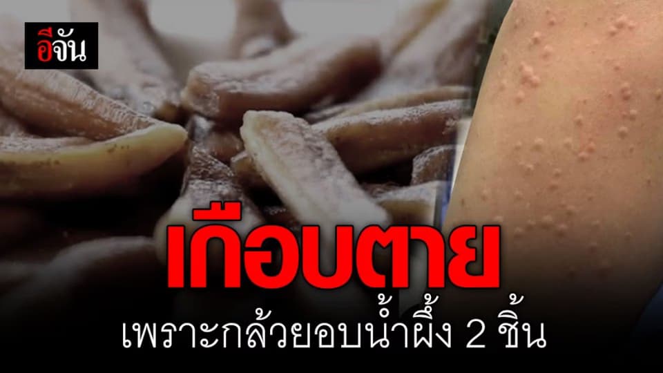 ใครจะไปคิด! กินกล้วยอบน้ำผึ้ง เกือบเอาชีวิตไม่รอด!
