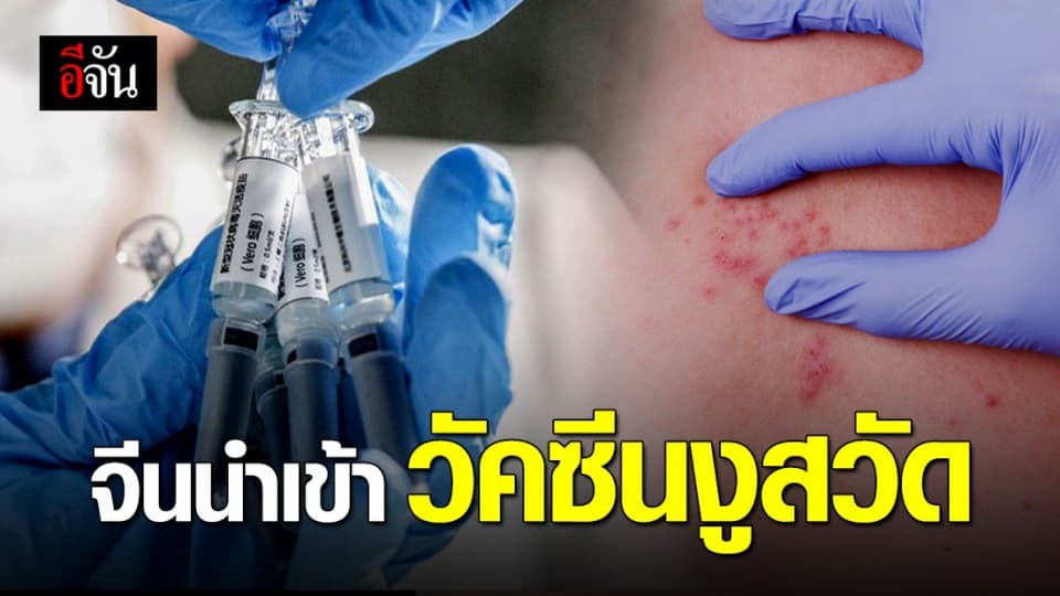 จีนนำเข้าวัคซีนงูสวัด ประเดิมใช้ในปักกิ่ง-เซี่ยงไฮ้