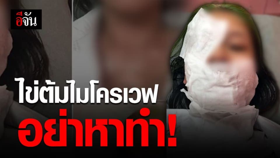 อย่าหาทำ! เอาไข่ใส่ไมโครเวฟ ไข่ระเบิด หวิดเสียโฉม