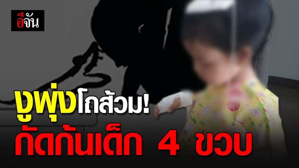แม่นึกว่าอึ? งูพุ่งโถส้วม กัดก้นลูกสาววัย 4 ขวบ