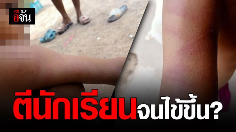 ป้าทนไม่ไหวขอมูลนิธิปวีณาฯ ช่วย ครูตีหลานจนระบม กลับบ้านไข้ขึ้น ซ้ำร้ายเคยตีมาก่อนหน้าแล้วครั้งหนึ่ง