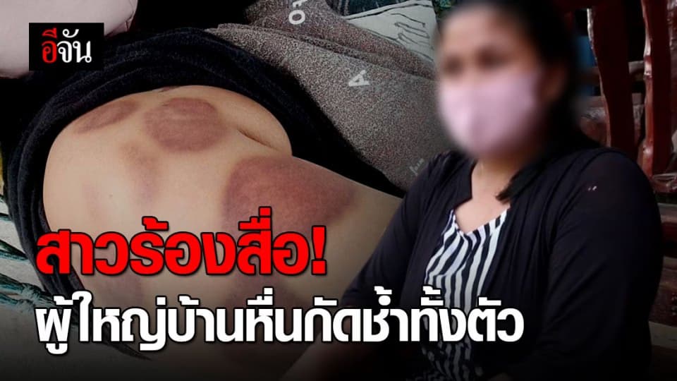 สาวชาวสุรินทร์ร้องสื่อ! ขอความเป็นธรรมถูกผู้ใหญ่บ้านอนาจาร