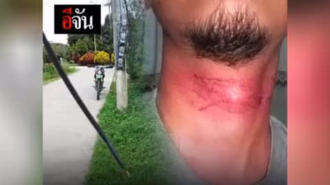 เกือบไม่ถึงบ้าน เพราะสายอินเทอร์เน็ตเกี่ยวคอ