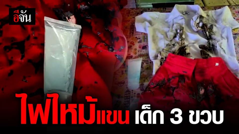 อุทาหรณ์ เด็ก 3 ขวบ นั่งเล่นเจลล้างมือ พี่ชายจุดไฟแช็กเกิดไฟลุกไหม้แขน เจ็บสาหัส