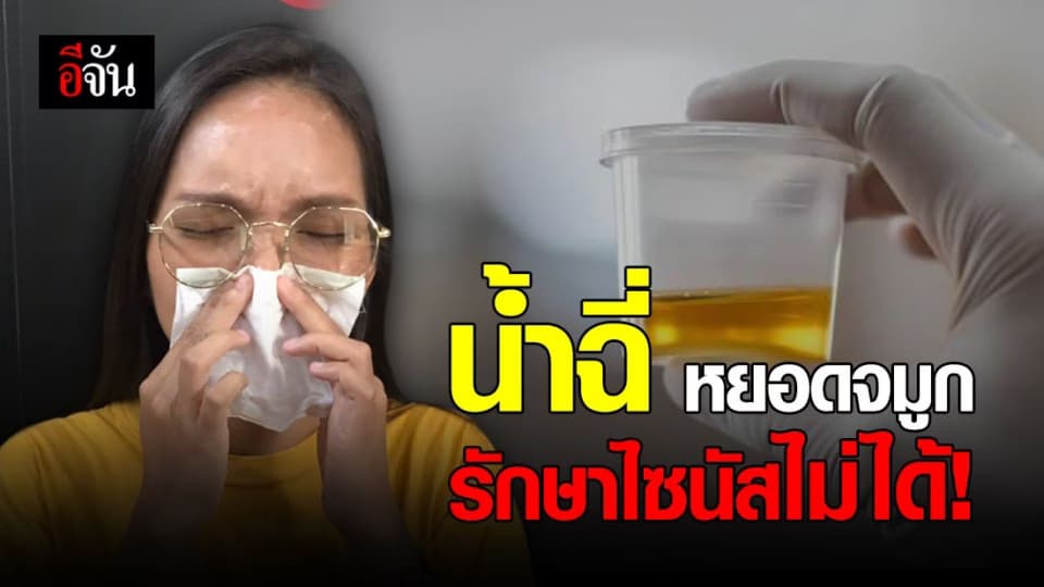 อย่าหาทำ! น้ำปัสสาวะหยอดจมูก รักษาโรคไซนัสไม่ได้