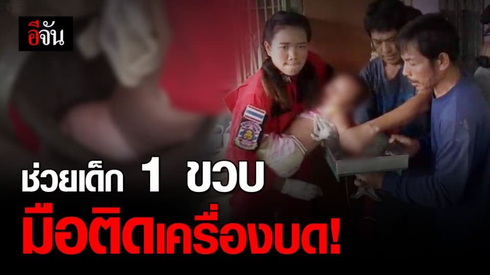 อุทาหรณ์ เด็ก 1 ขวบ มือติดเครื่องบดข้าวโพด