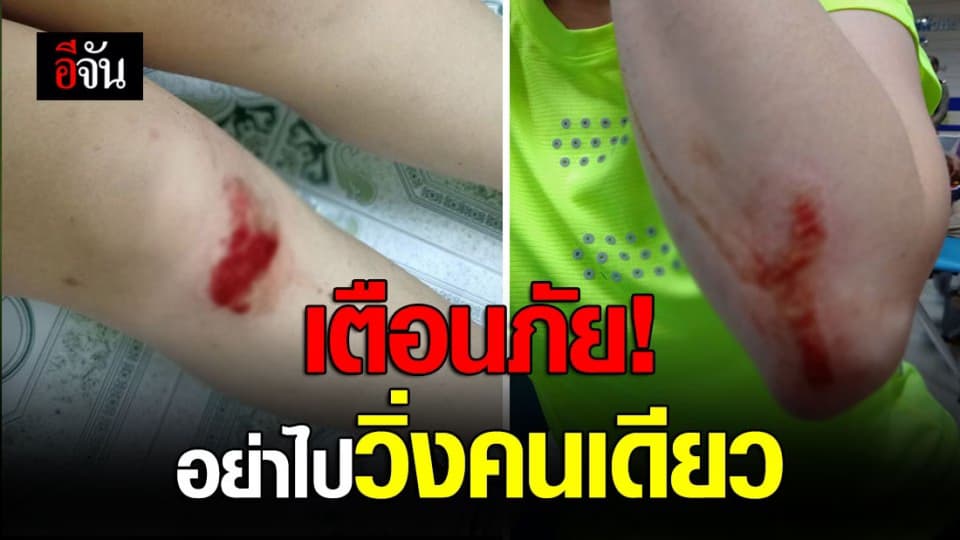 สาวโพสต์เตือนภัย ไปวิ่งคนเดียว เจอคนเดินตาม ฉุดเข้าข้างทาง