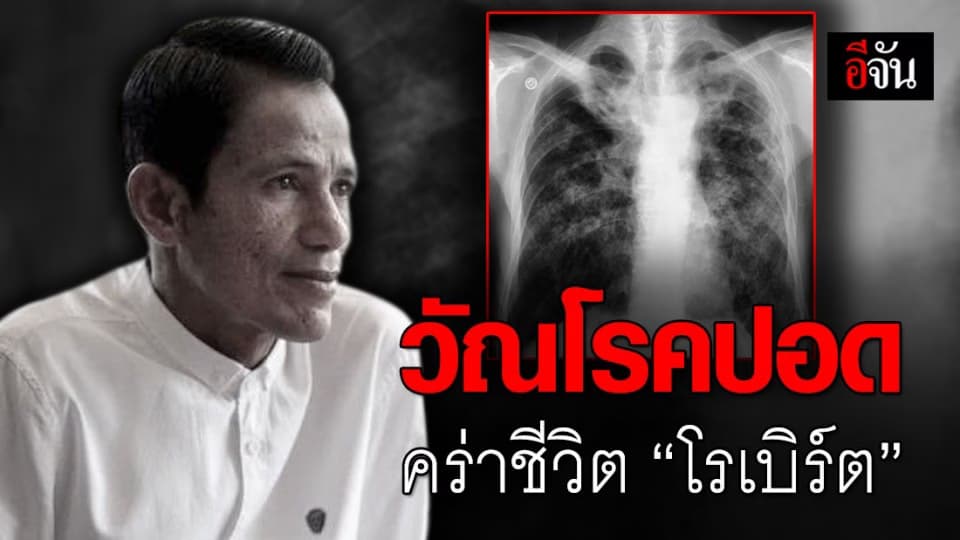 “วัณโรคปอด” โรคใกล้ตัวที่ไม่ควรมองข้าม