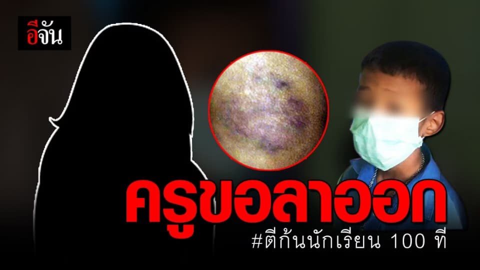 แสดงสปิริต? ครูอัตราจ้างตี นร. 100 ที “ขอลาออกเอง”