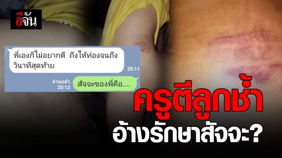 แม่ช็อก! ครูติวเตอร์ตีลูกช้ำทั่วตัว