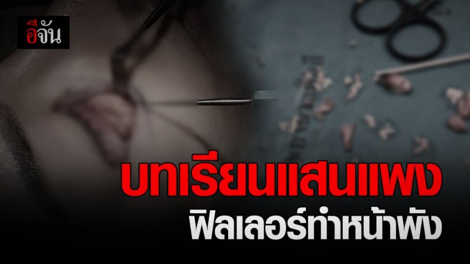 เปิดใจ! สาวฉีดฟิลเลอร์ (ปลอม) เป็นก้อนอักเสบ ถ้าไม่รักษามีสิทธิ์เน่า