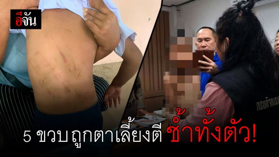 เด็กชาย 5 ขวบ ถูกตาเลี้ยงตี ยายแท้ๆบิดหูฉีก !