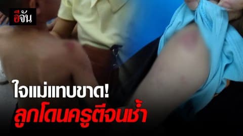 แม่โร่แจ้งความ อ้างลูกชายโดนครูตี จนร่างกายช้ำ