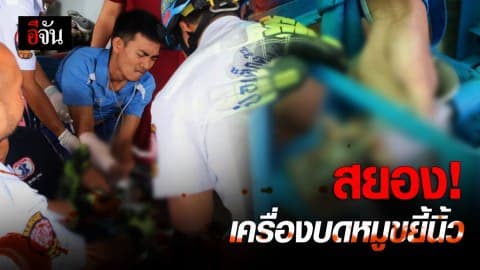 สยอง!!! เครื่องบดหมูขยี้นิ้วมือเละ