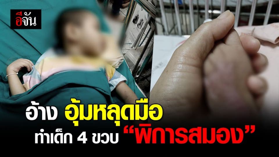 สะเทือนใจ! “ เพื่อนแม่ ” เด็ก 4 ขวบ อ้าง อุ้มหลุดมือ ทำเด็ก “ พิการสมอง ”