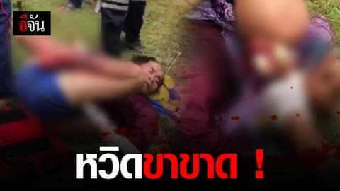 สยอง!!! ชายกัมพูชาถูกใบพัดตีน้ำ ฟันขาเกือบขาด