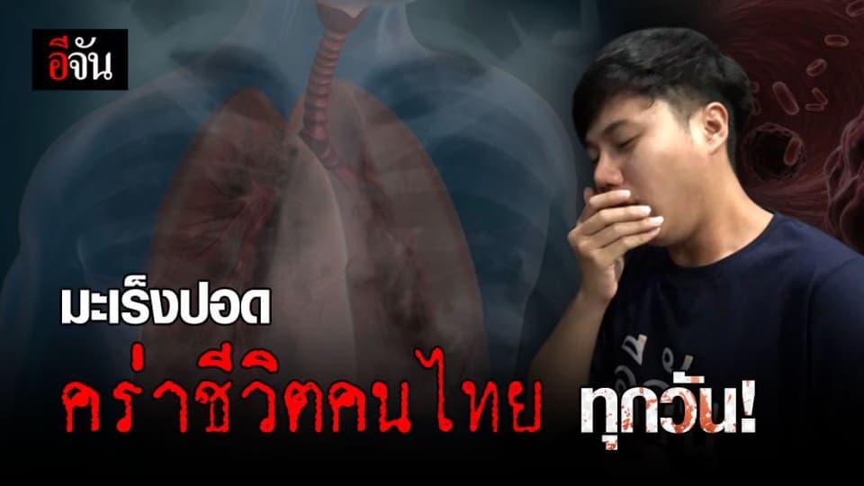 เช็กก่อนสาย! กรมการแพทย์ เตือน “ มะเร็งปอด “ คร่าชีวิตคนไทย ทุกวัน