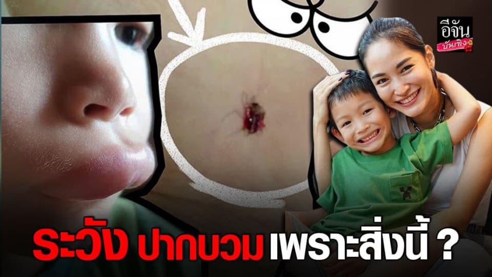 ตกใจจนรีบพาไป รพ. พลอย พลอยพรรณ เผยสาเหตุ น้องพูม่า ปากบวมเจ่อ