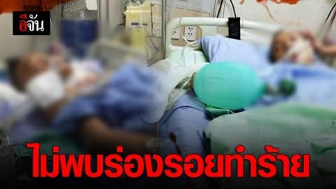 ไม่พบร่องรอยฟกช้ำเเละยังไม่นึกถึงเรื่องคดี