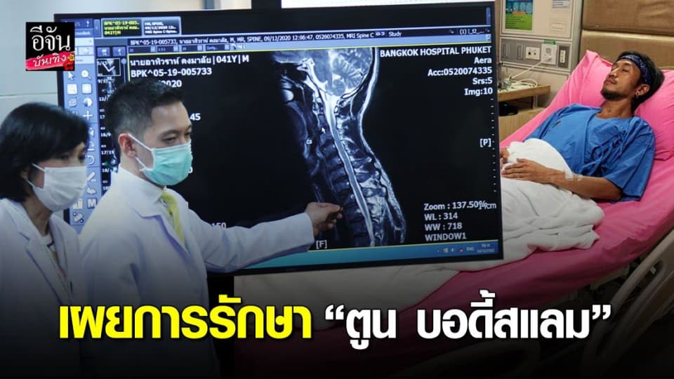 ตูน บอดี้สแลม หมอนรองกระดูกคอกดทับเส้นประสาท ทีมแพทย์เฝ้าดูอาการ 2 สัปดาห์