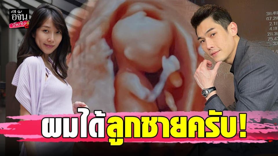 กันต์ – พลอย เผยรูปภาพอัลตราซาวนด์ เฉลยเพศลูก ?