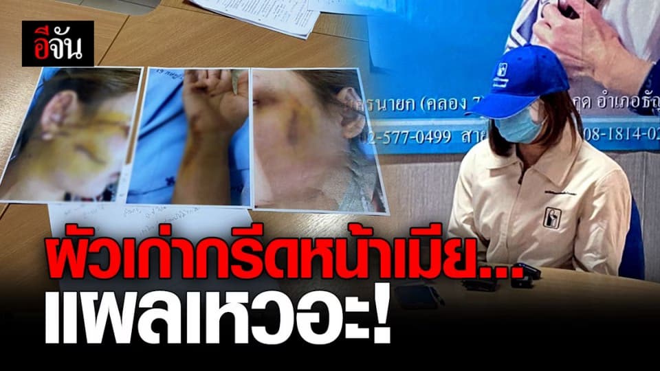 สาวร้องปวีณา ผัวเก่าโหด นัดหย่า แต่ตลบหลังใช้ คัตเตอร์กรีดหน้าเมีย เย็บเกือบ 100 เข็ม
